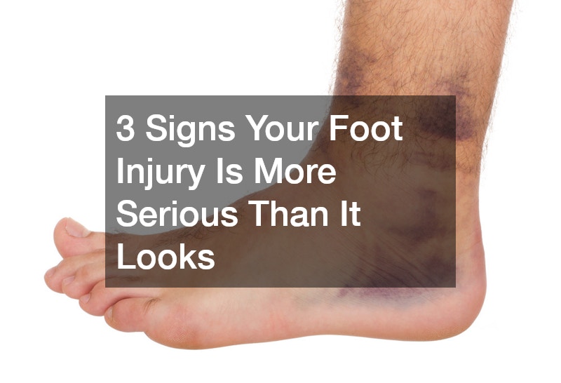 3 Signs Your Foot Injury Is More Serious Than It Looks